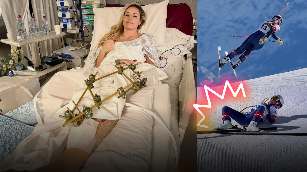 Terzo intervento per Lindsey Vonn: aggiornamento dall’ospedale dopo il terribile infortunio alle Olimpiadi