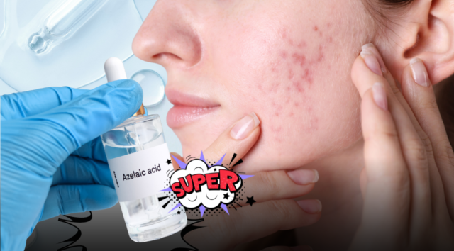 Acido azelaico: il segreto insospettabile della skincare che surclassa i principi attivi più famosi