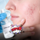 Acido azelaico: il segreto insospettabile della skincare che surclassa i principi attivi più famosi