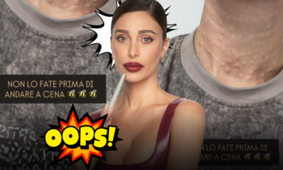 Belén Rodriguez mostra il collo pieno di bolle e lancia un avviso ai fan: «Non fatelo mai prima di andare a cena fuori»