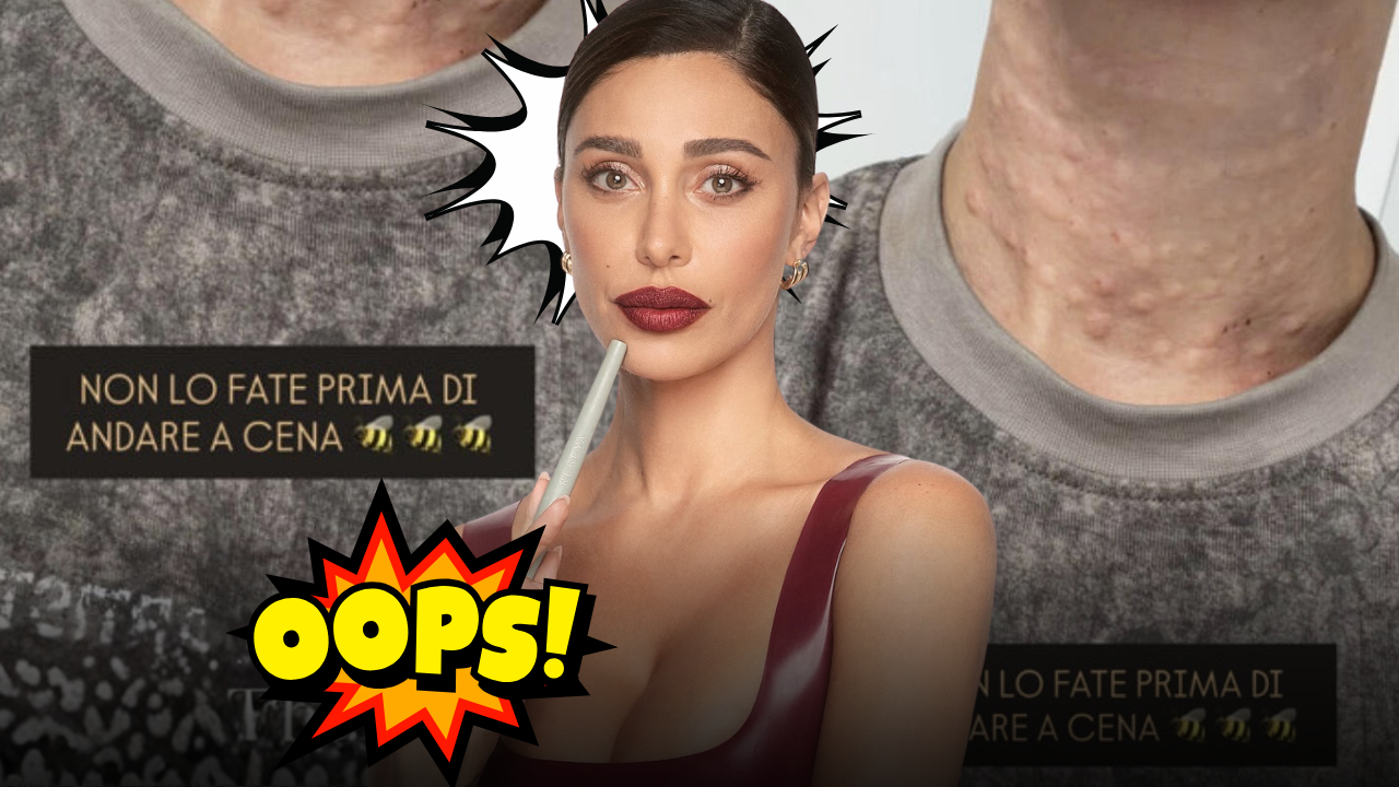 Belén Rodriguez mostra il collo pieno di bolle e lancia un avviso ai fan: «Non fatelo mai prima di andare a cena fuori»