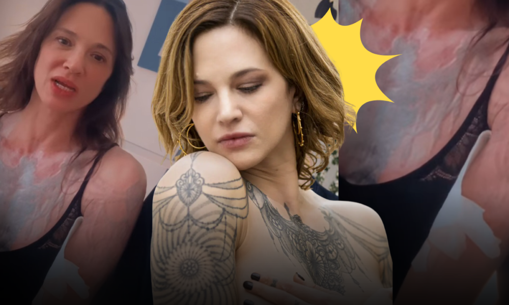 Asia Argento cancella tutti i tatuaggi a 51 anni: «Un errore di gioventù, cancellarli è un percorso davvero doloroso»