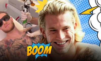 Loris Karius cancella i tatuaggi sul collo con il laser: il marito di Diletta Leotta si pente dei tattoo e segue la nuova tendenza dei vip